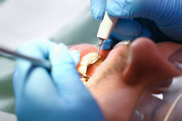 Best Urgent Dental Care for Toothache in Hope Valley, RI