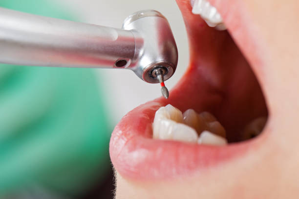 Best Pediatric Emergency Dentist in Hope Valley, RI